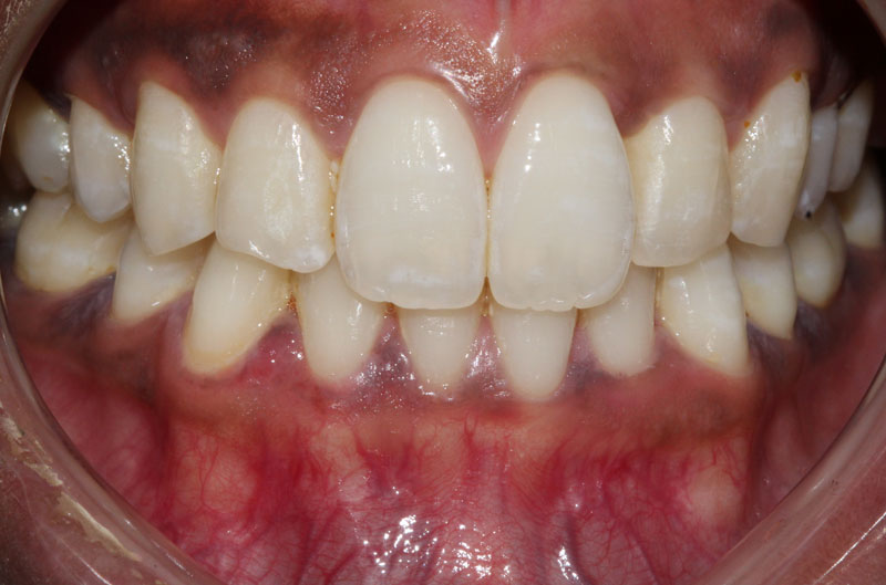 0681 after