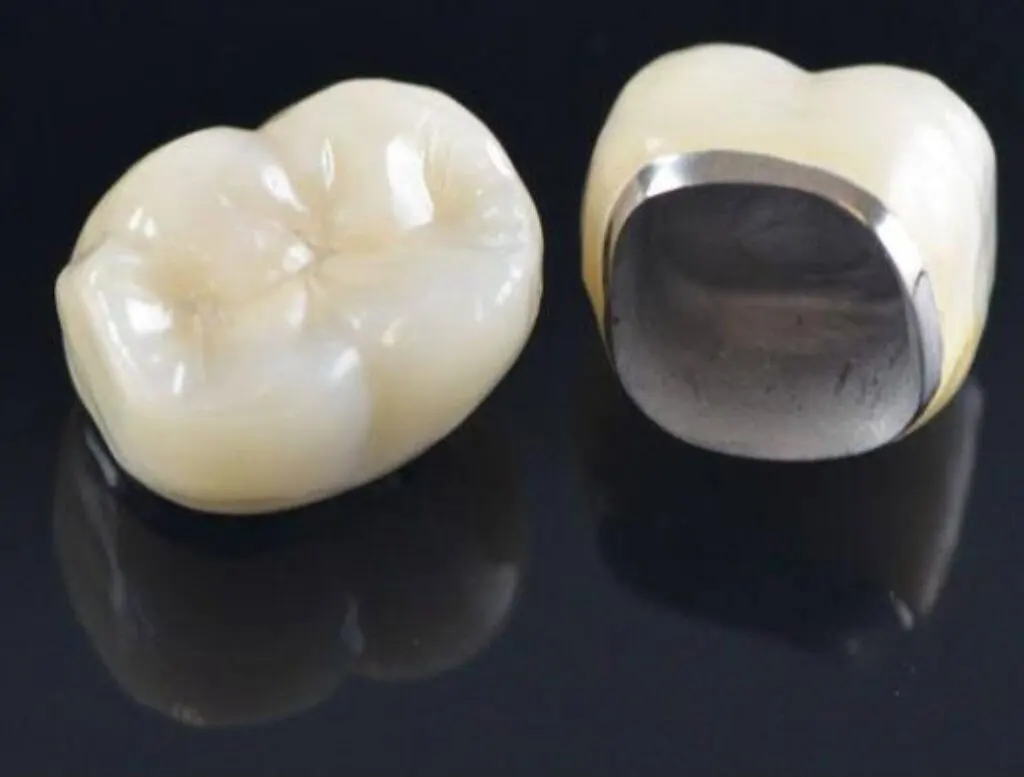 Copy of Porcelain bonded to metal alloy
