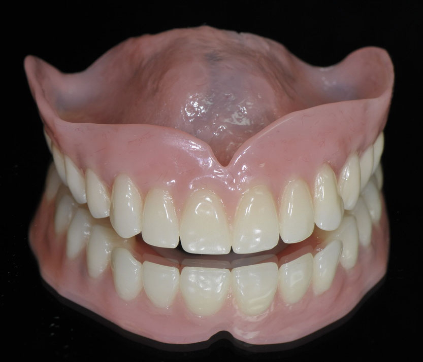 Full-denture-img Full denture img