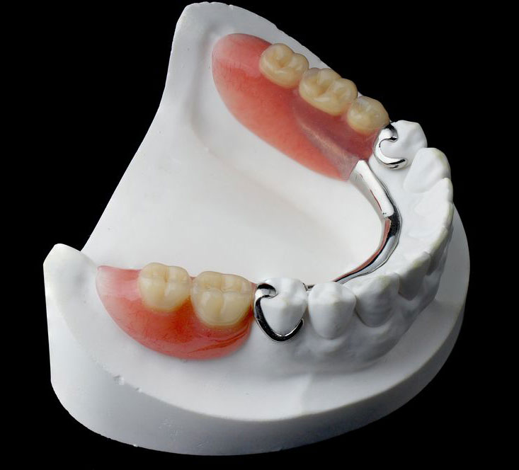 Partial-Dentures-img Partial Dentures img