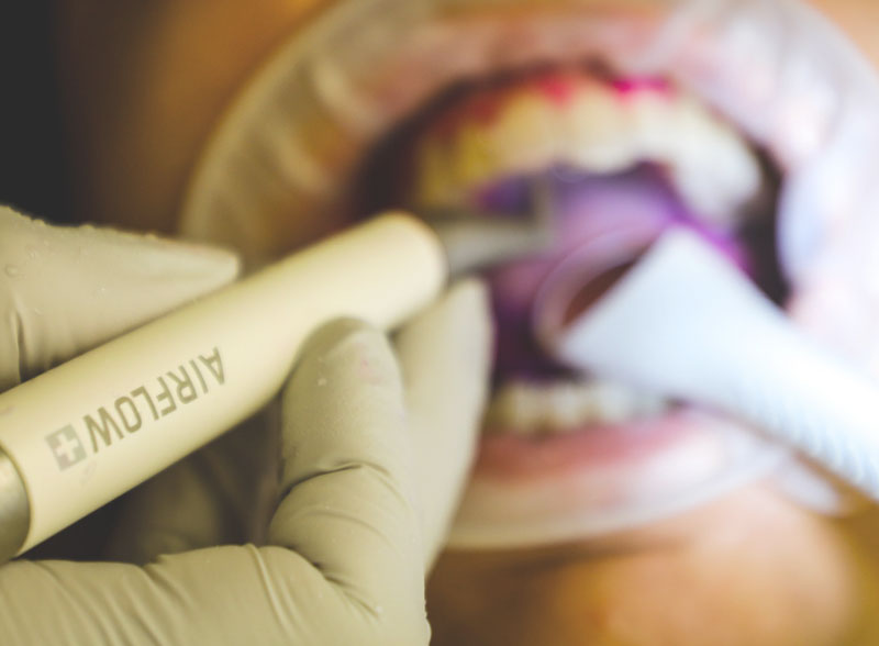 The Minimally Invasive Way img