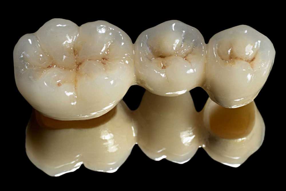 Ceramic cap img