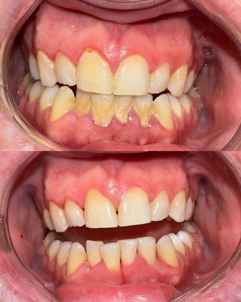 Dental hygienist img 3