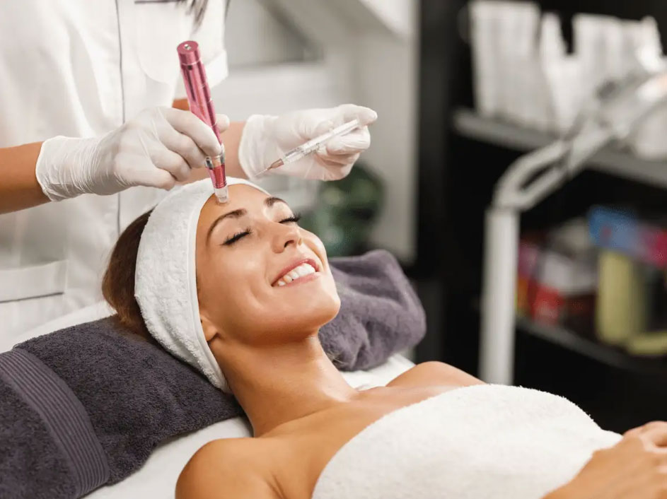 Microneedling PRP treatment img