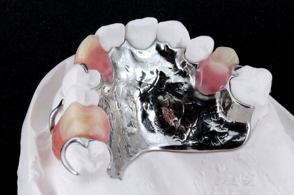partial-upper-chrome-3-teeth-img Partial upper chrome 3 teeth img