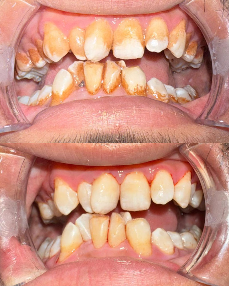 Routine hygiene img