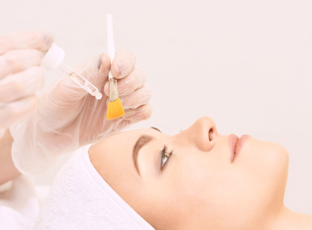 chemical-peel-img