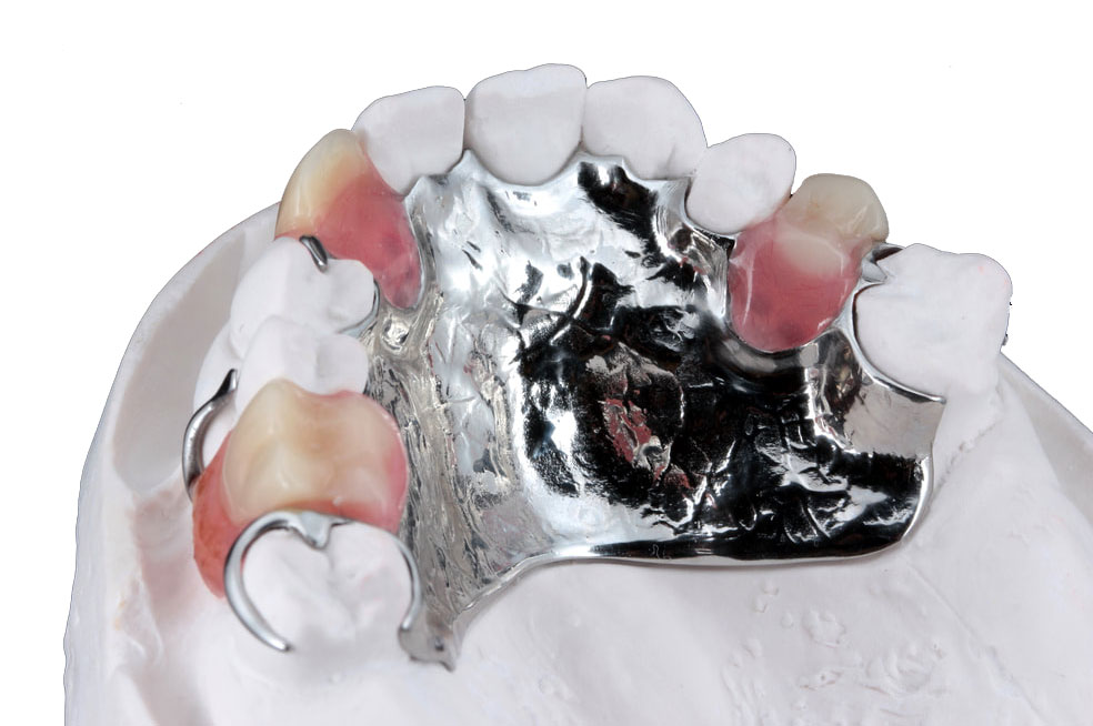 partial-upper-chrome-3-teeth-img-2