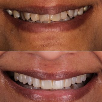 composite-20-img