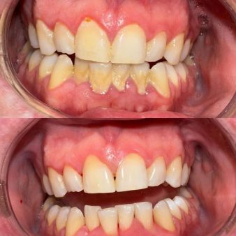 dental-hygienist-img-3